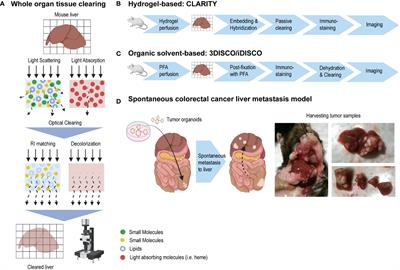 Tissue clearing and immunostaining to visualize the spatial organization of vasculature and tumor cells in mouse liver